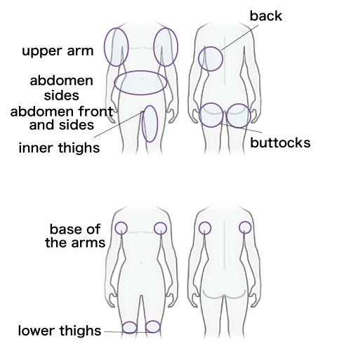 Upper arm, abdomen, inner thighs, sides, upper thighs